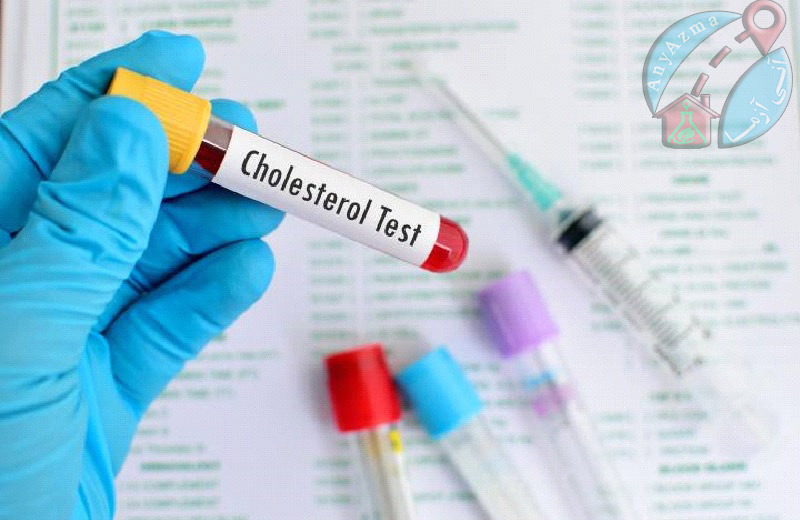 آزمایش کلسترول خون جهت درمان بیماریها