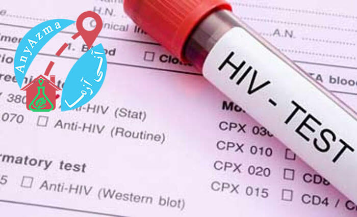 برای تشخیص ایدز HIV چه آزمایشاتی باید انجام داد؟