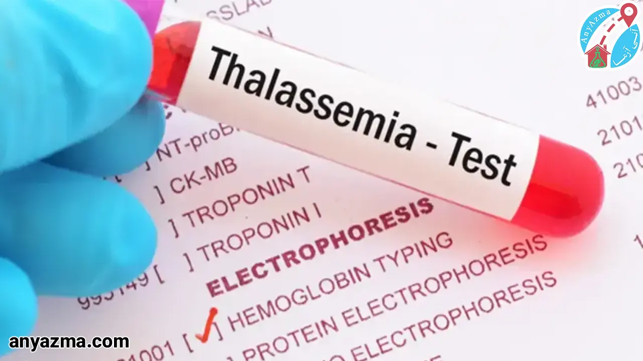 تالاسمی چیست و چه علائمی دارد