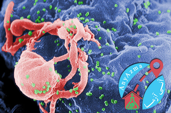 آزمایش ایدز جهت تشخیص ویروس Hiv