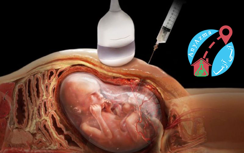 آزمایشات بارداری برای اطمینان از سلامت مادر و جنین