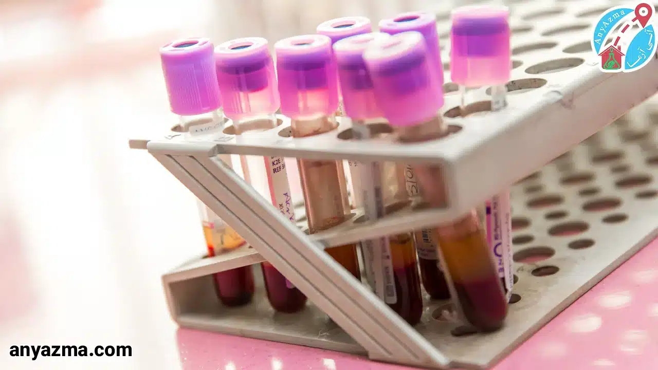 آزمایش آنزیم قلبی چیست؟