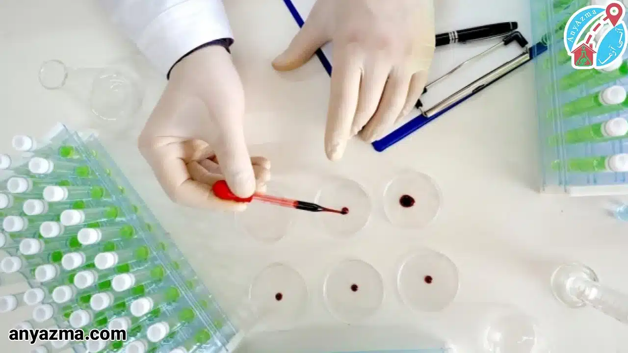 آزمایش آنزیم قلبی چیست؟