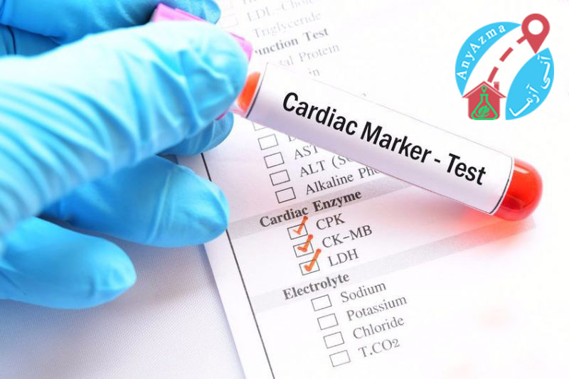 آزمایش آنزیم های قلبی شامل چه تست هایی می باشد؟