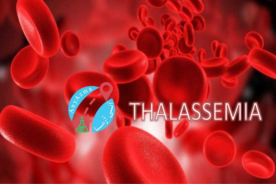 تشخیص تالاسمی با آزمایش CBC و الکتروفرز (Hb elect) و کروماتوگرافی ستونی