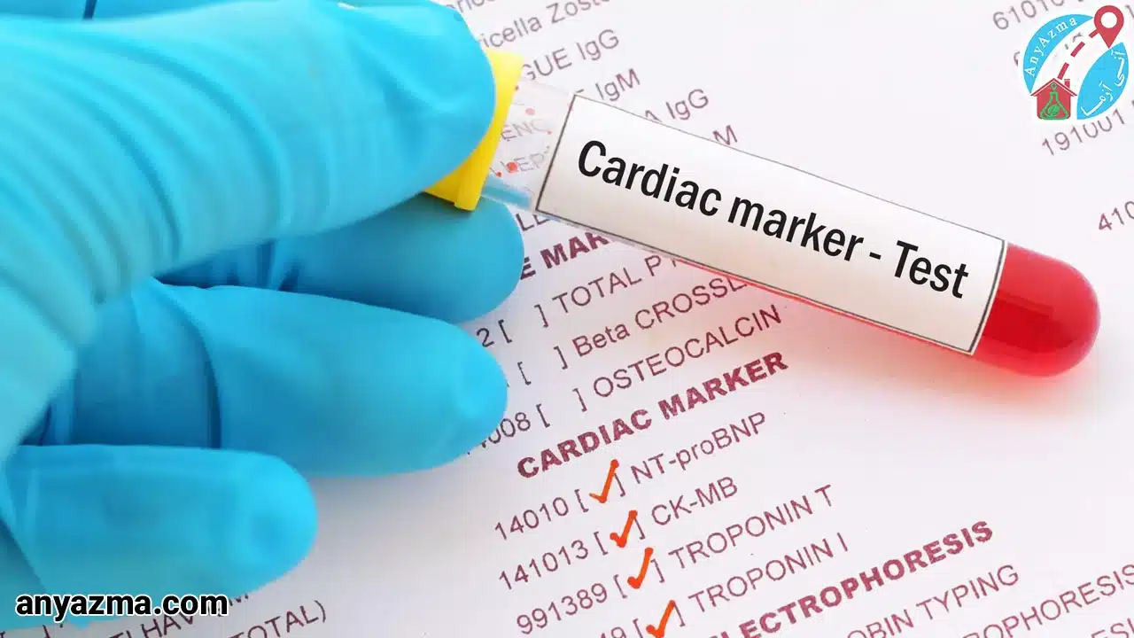 آزمایش آنزیم قلبی چیست؟