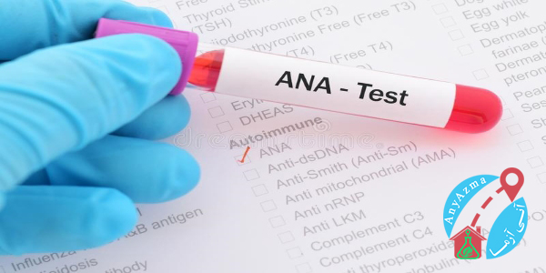 آزمایش ANA و آزمایش Anti-dsDNA در چه مواردی استفاده می شوند