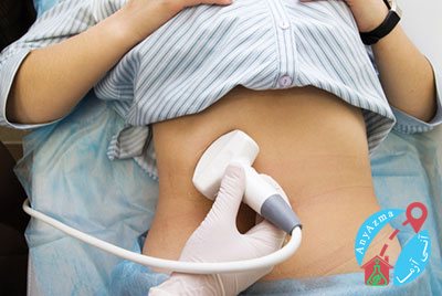 چه آزمایشاتی برای تشخیص تنبلی تخمدان یا سندرمتخمدان پلی کیستیک استفاده می شود