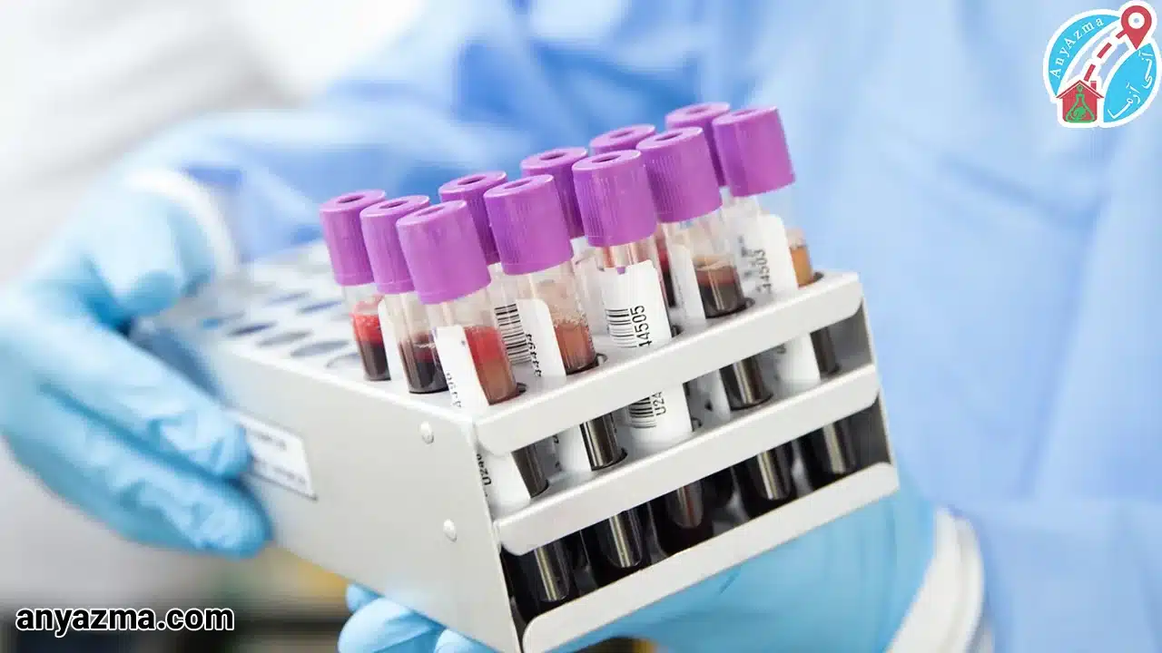 تفسیر نتایج آزمایش گلبول های سفید خون