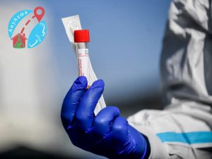 آزمایش آنتی بادی کرونا ویروس و چگونگی تولید آنتی بادی علیه ویروس توسط بدن