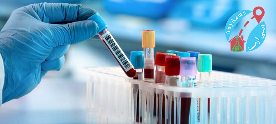 آزمایش خون: انواع ، آزمایشات معمول ، نتایج و موارد دیگر