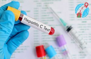 آزمایش هپاتیت C چیست و چرا آزمایش مهمی می باشد
