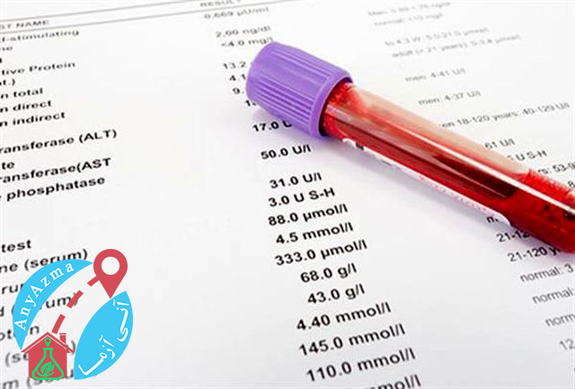 آزمایش خون: انواع ، آزمایشات معمول ، نتایج و موارد دیگر