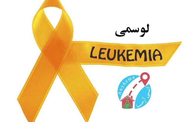 آنچه باید درباره ی بیماری لوسمی بدانید