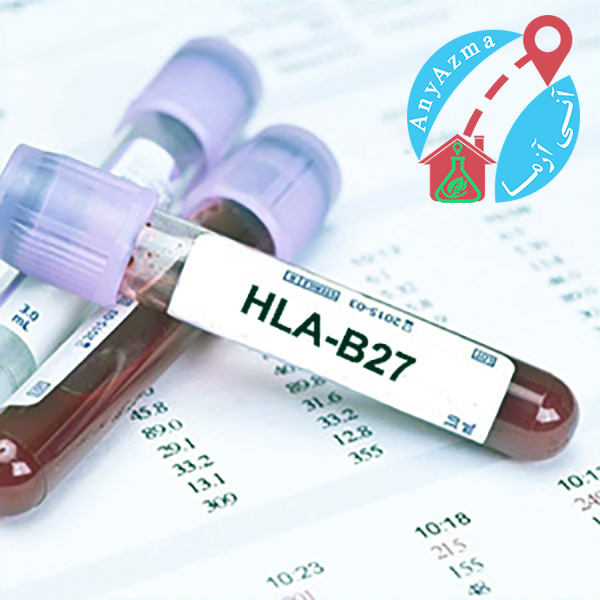 آزمایش HLA-B27