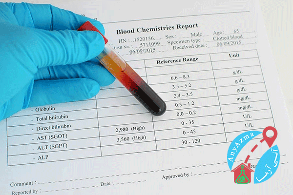 آزمایش AST و آزمایش ALT