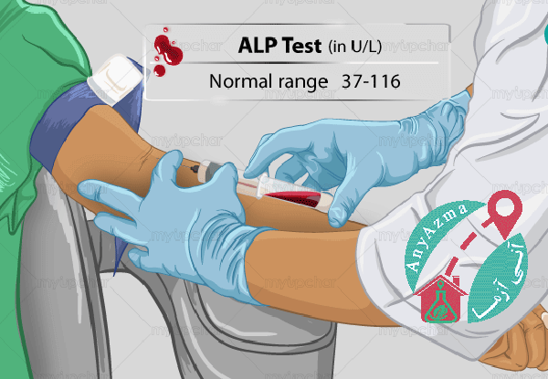 آزمایش ALP چیست و در چه مواردی درخواست می شود