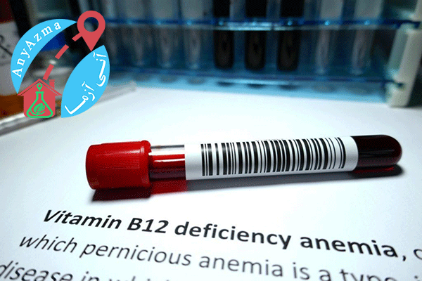 اهمیت تشخیص به موقع کمبود ویتامین B12 و کمبود اسید فولیک