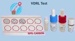 آزمایش تشخیص سفیلیس ( VDRL)