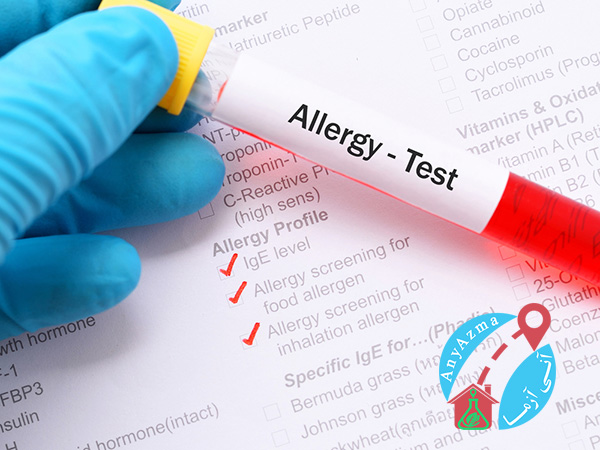 آلرژی چیست و چگونه تشخیص داده می شود