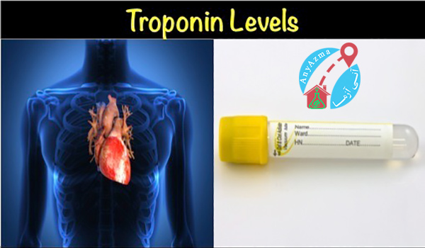 آزمایش تروپونین چیست؟