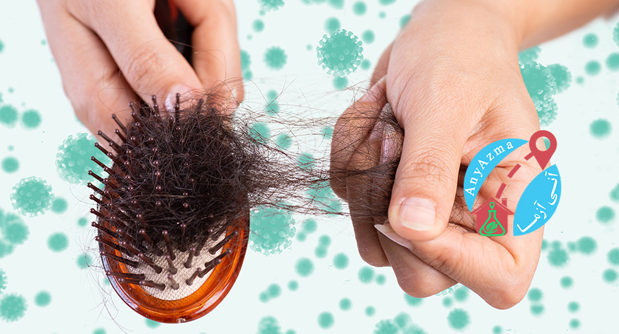علت و درمان ریزش مو در کرونا