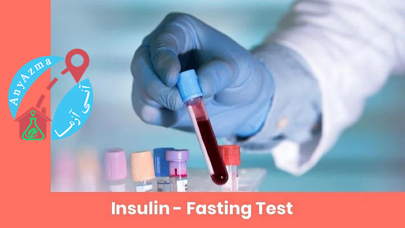 اهمیت آزمایش انسولین در بیماران دیابتیک