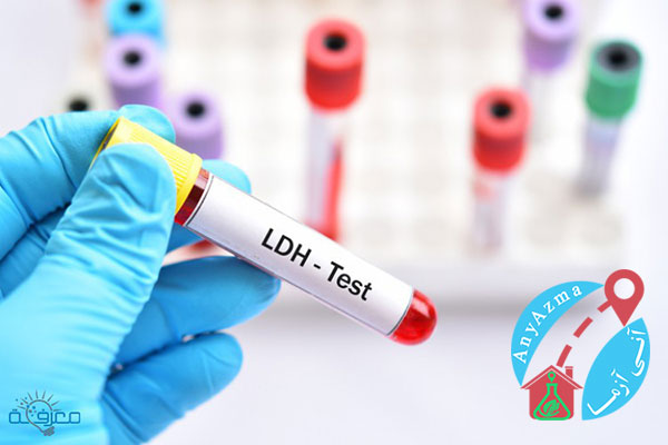 آزمایش LDH