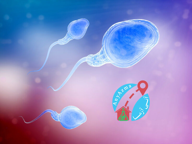 آزمایش اسپرم یا اسپرموگرام، شرایط مورد نیاز و کاربردهای آن