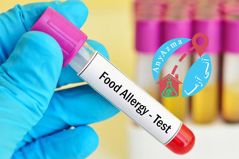 آزمایش آلرژی غذایی چیست؟