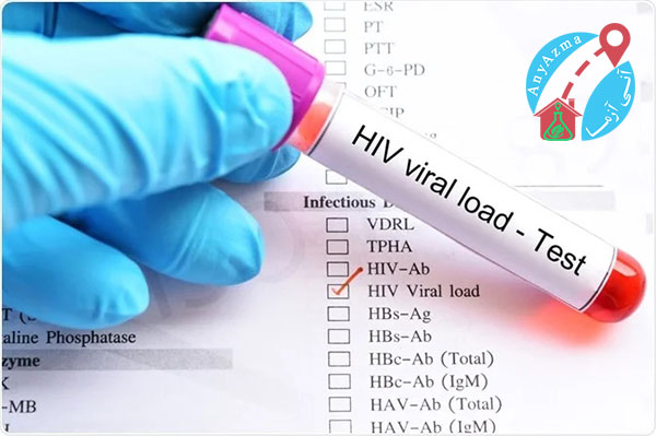 تست ویروس نقص ایمنی انسانی (HIV).