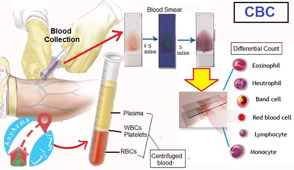 آزمایش شمارش کامل خون (CBC)