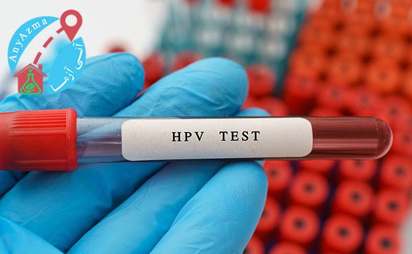 آیا خطری برای آزمایش وجود دارد؟آیا خطری برای آزمایش HPV وجود دارد؟