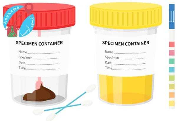 آزمایش ادرار و مدفوع