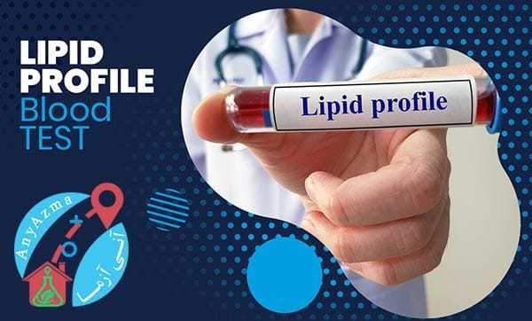 آزمایش چکاپ در منزل ایلام توسط تست خون