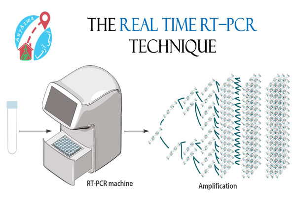  real time RT–PCR 