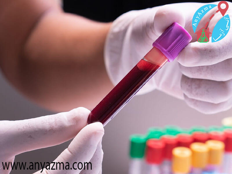 دقت جواب آزمایش خون، وابسته به عوامل مختلف