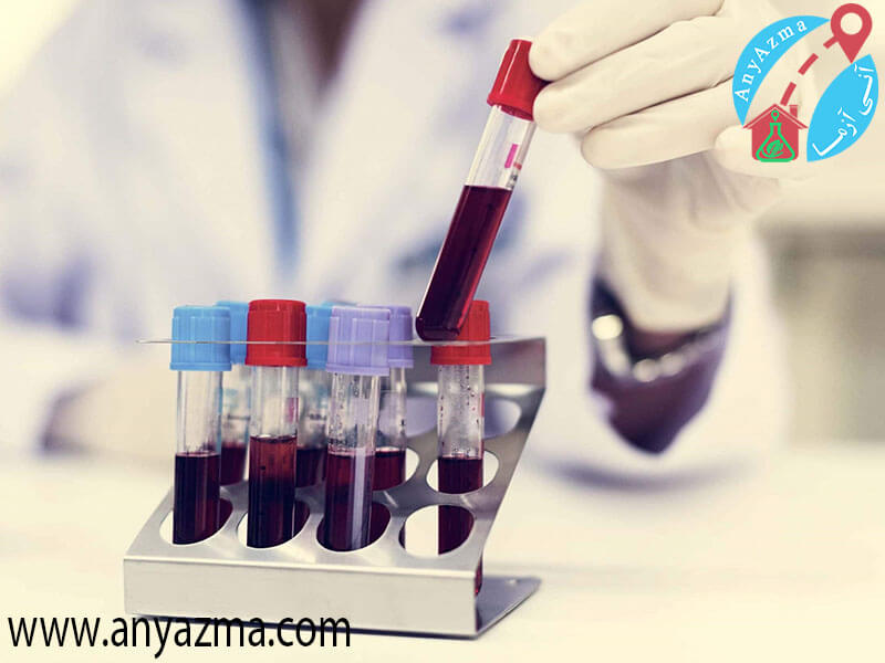 معرفي آزمايش هاي خون اصلي و مهم