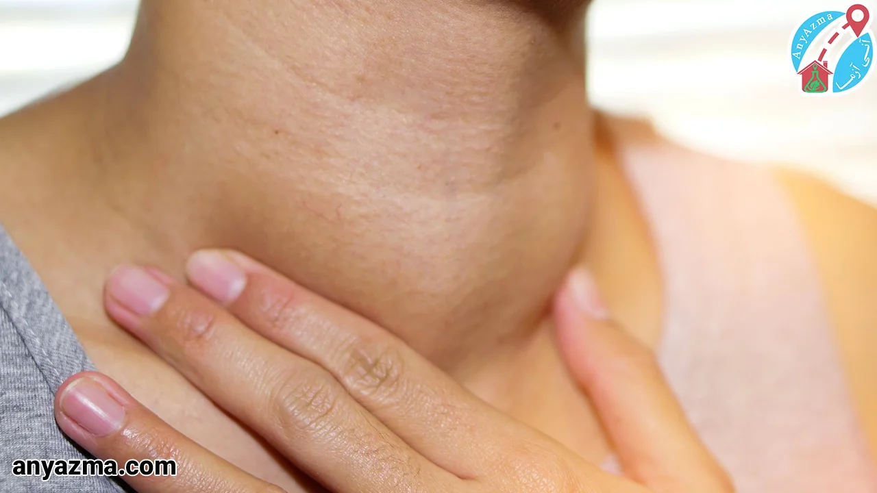 اختلال تیروئید کم کار براساس منشأ اختلال، شدت و زمان بروز آن به دسته‌بندی‌های مختلفی تبدیل می‌شود