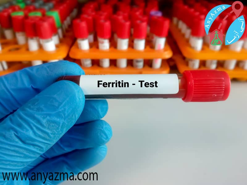 تفسیر آزمایش ferritin