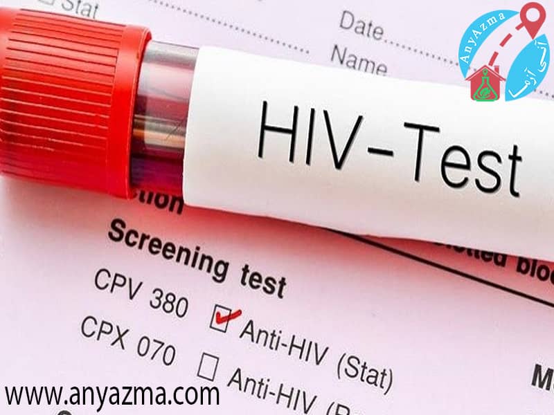 تست آزمایش اچ آی وی