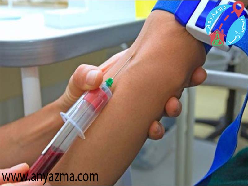 گرفتن خون برای آزمایش تیروئید  تست های تیروئید که به آزمایش خون نیاز دارند