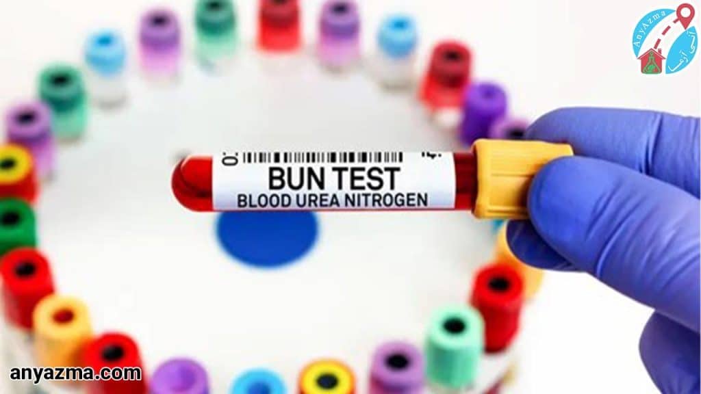 آزمایش BUN