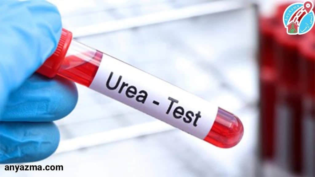 آزمایش urea خون