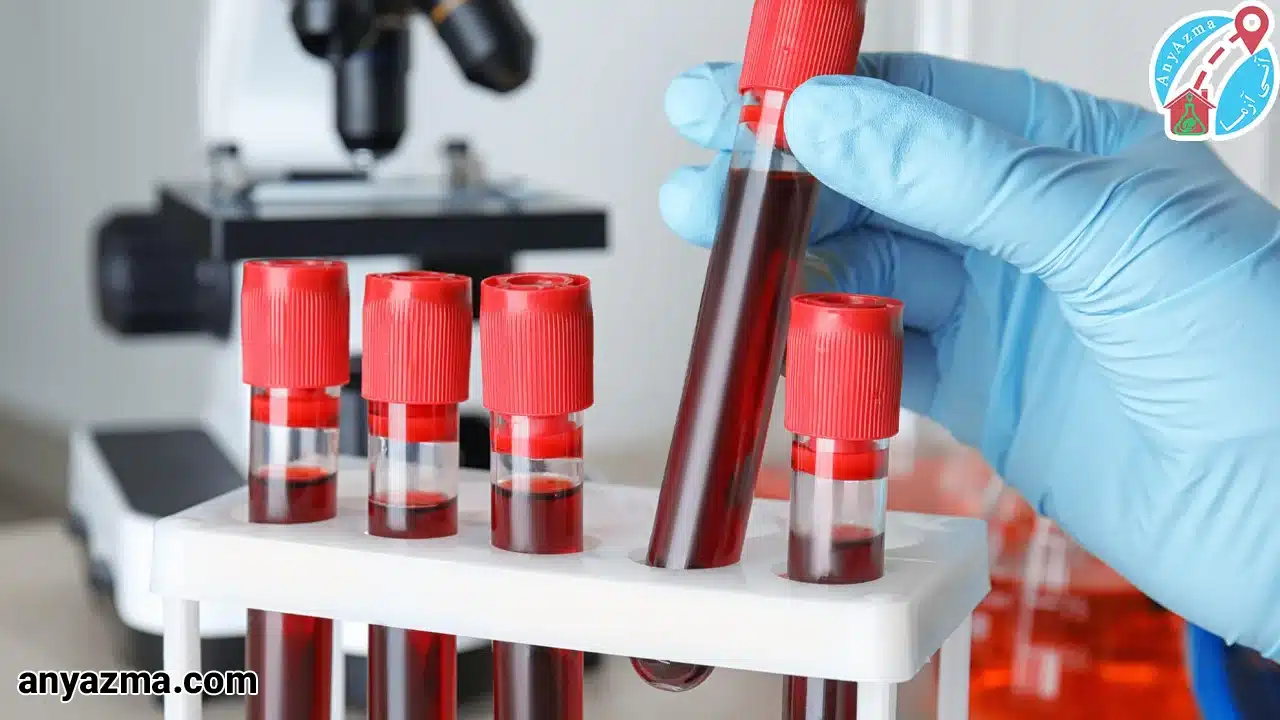 hb در آزمایش خون چیست؟