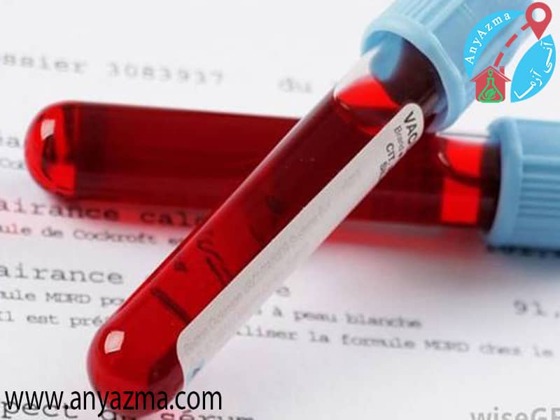 علت تجویز آزمایش خون PCT چیست؟
