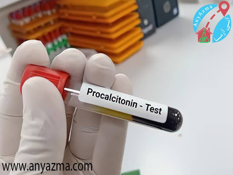 PCT در آزمایش خون چیست؟