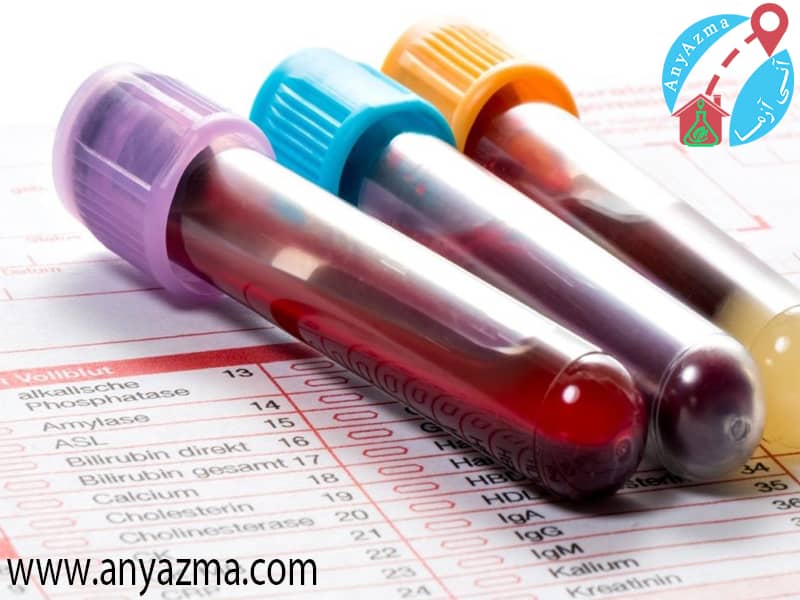 رسوب گلبول قرمز و esr در آزمایش خون چیست؟