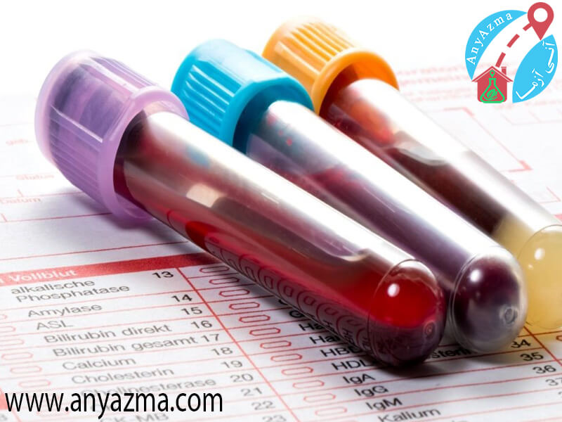 چگونگی خواندن آزمایش خون پیش از مراجعه به پزشک