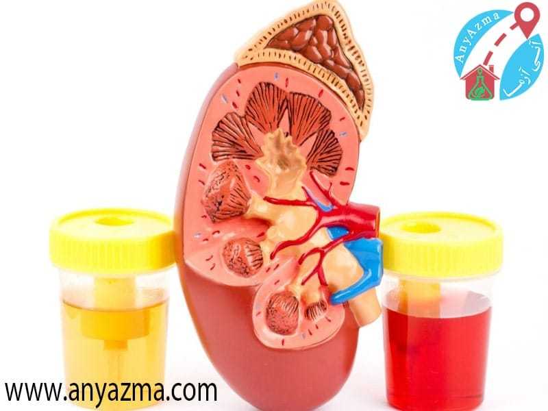 وجود rbc در آزمایش ادرار و تفاوت رنگ بین ادرار سالم و خونی